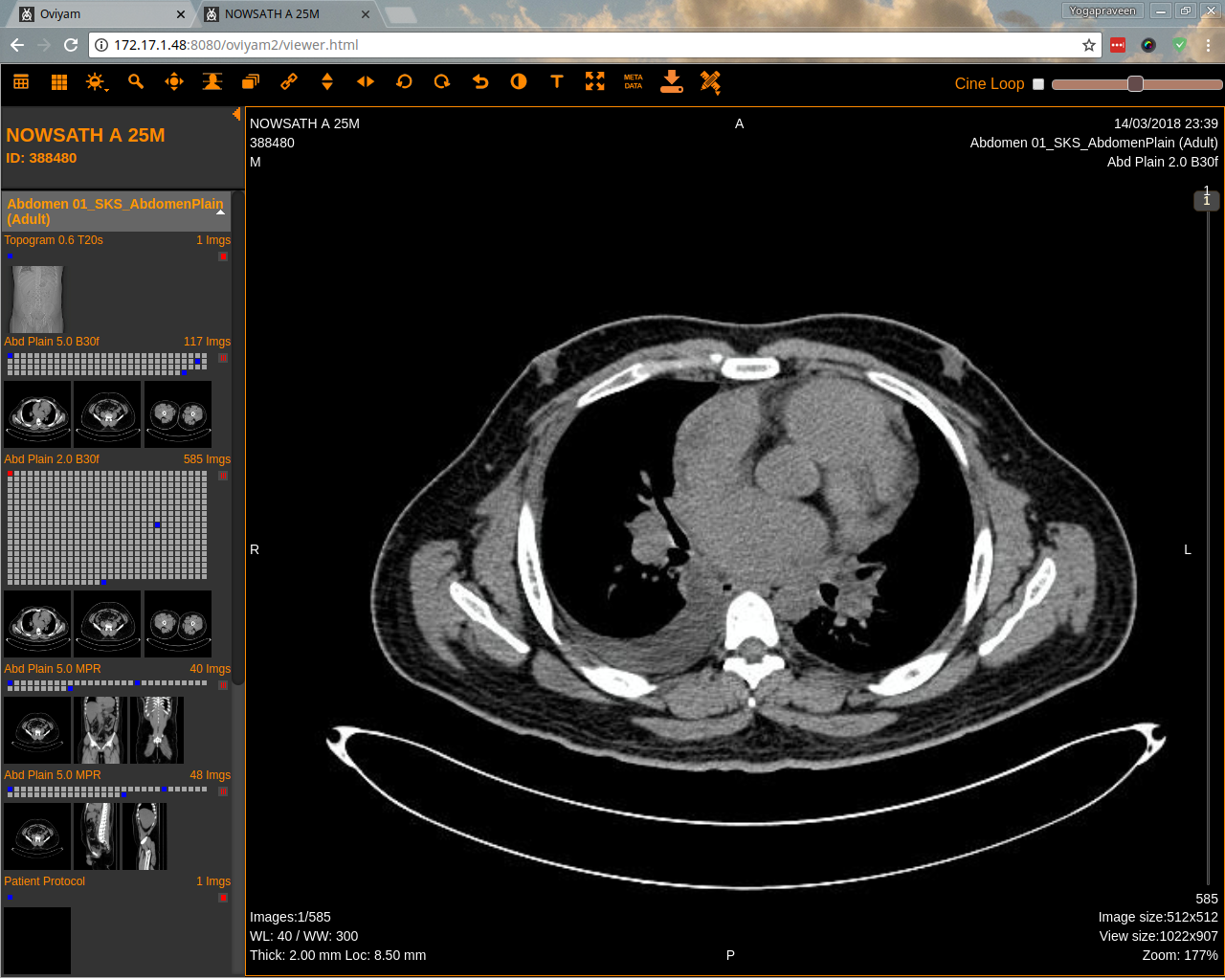 online DICOM viewer